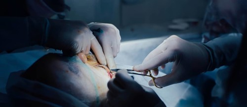 Hands performing a surgical procedure with precision, the focus on incision work