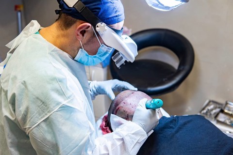 Doctor performing hair transplant. Surgeons in the operating room carry out hair transplant surgery