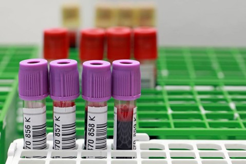 Blood donation