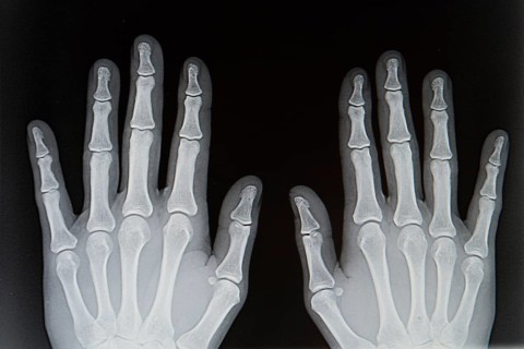 X-ray from human hands