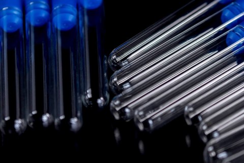 Laboratory Test Tubes on Black Background