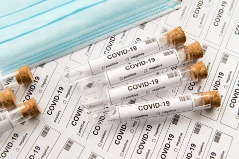Many covid-19 test tubes for lots of testing