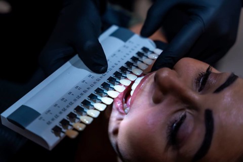 Dentist comparing patient's teeth shade with tooth whitening shade guide palette in dental clinic