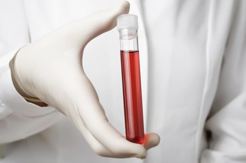 Doctor holding a bottle of blood sample