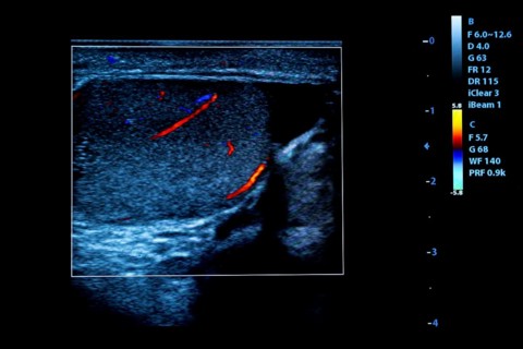 Colourful image of modern ultrasound monitor. Ultrasonography machine. High technology medical and