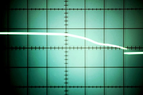 Asystole of the heart, a cardiac arrest and a zero line displayed on an oscilloscope