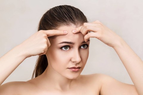 Young girl squeezes pimple on her forehead over beige background
