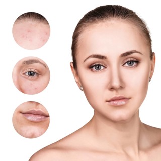 Portrait of young woman and circles shows problem skin over white background