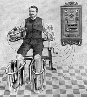 An illustration of a patient being treated with a four cell Schnee Bath, an early electric medical