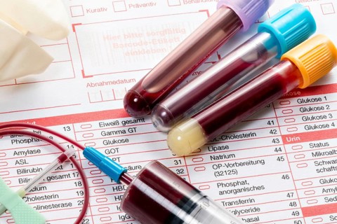 Blood samples are taken on a laboratory form to determine the blood values