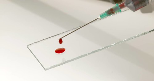 Blood dropping from Needle against White Background