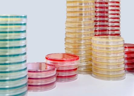 Lots of stacked petri dishes filled with colorful agar growth medium