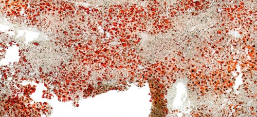 Full frame abstract microscopic detail of a human fatty liver