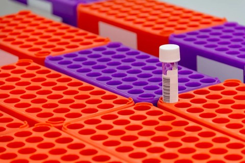 Closeup shot of medical sample racks