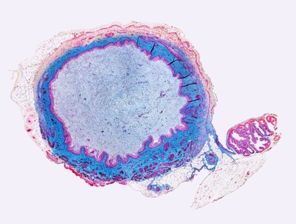 Micrograph showing the urinary bladder from a rat