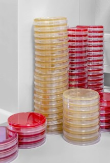 Lots of stacked petri dishes filled with colorful agar growth medium