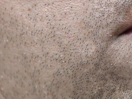 The skin of the man's face with stubble and flaky skin, sparse, gray hairs in the beard. Karaganda,
