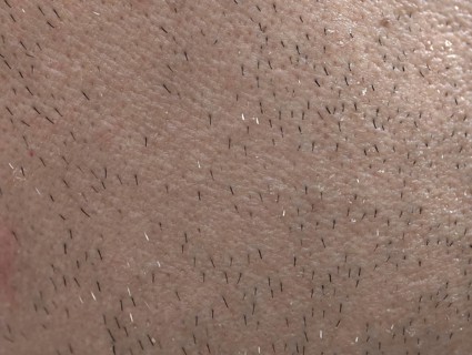 The skin of man's face with stubble and flaky skin, sparse gray hairs in the beard, Karaganda,