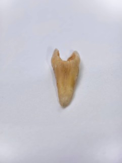 Pulled out, cracked and damaged tooth, second premolar on a white background, Karaganda, Kazakhstan