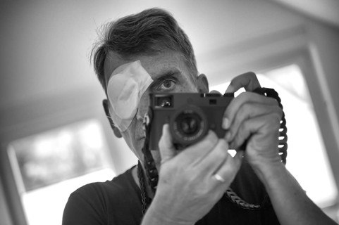 Portrait, self-portrait, selfie, photographer with eye bandage, eye injury, bandage on eye, holding