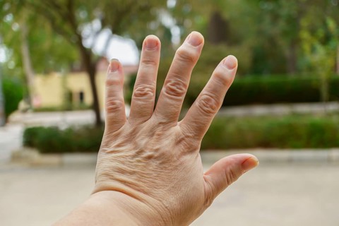 Close-up of wrinkled hand demonstrating osteoarthritis symptoms, highlighting age-related joint