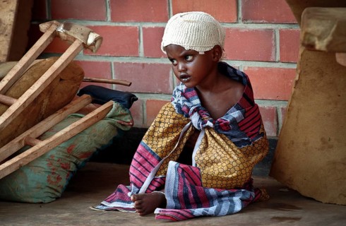 RWA Rwanda Kigali Injured Tutsi refugee children receive medical care in a makeshift hospital by