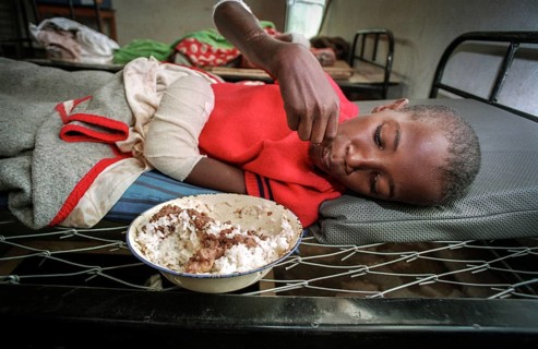 RWA Rwanda Kigali Injured Tutsi refugee children receive medical care in a makeshift hospital by