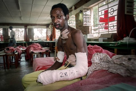 RWA Rwanda Kigali Injured Tutsi refugee receives medical care in a makeshift hospital by doctors