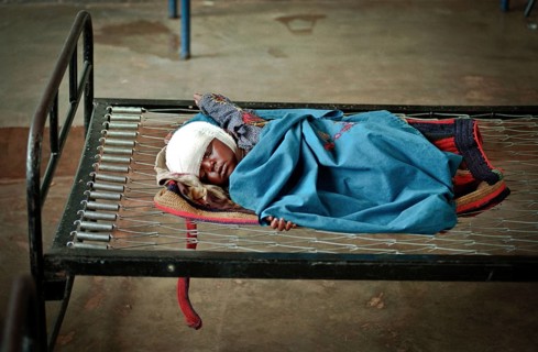 RWA Rwanda Kigali An injured Tutsi refugee child is receiving medical care in a makeshift hospital