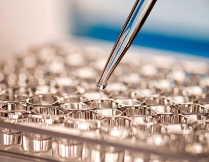 Reflective wells shimmer as a pipette releases a precise droplet, Pipette dispensing a liquid onto