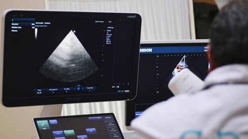 A gynecologist performing an ultrasound examination for an elderly displaced woman inside a mobile