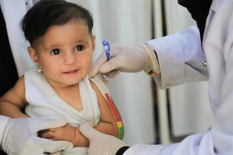 A doctor examines children's malnutrition inside a refugee camp. Malnutrition was measured using a