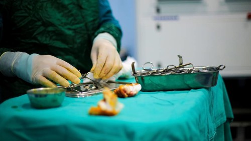 Several doctors performing a complex surgical operation inside an operating room for a displaced
