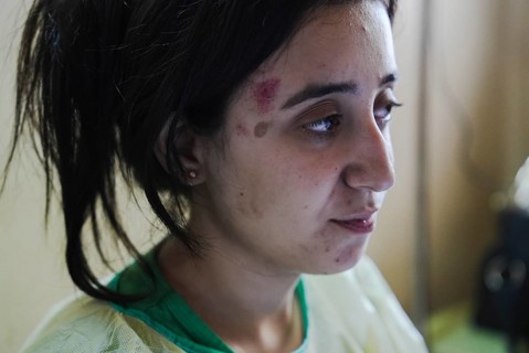 Wounded individuals receiving treatment at a hospital after being evacuated with difficulty from