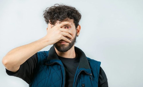 Person with eye infection looking at camera. Close up of man with red eyes suffering from