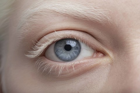 Close up of a woman's eye with white eyebrows and eyelashes, highlighting unique beauty of albinism