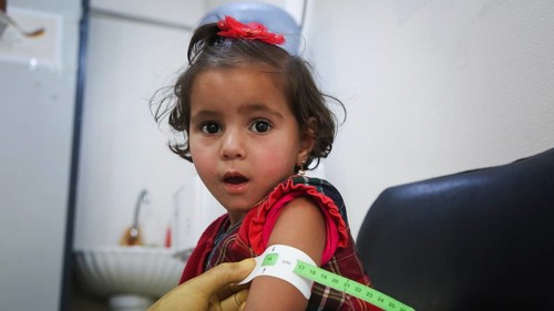 A doctor examines children's malnutrition inside a refugee camp. Malnutrition was measured using a