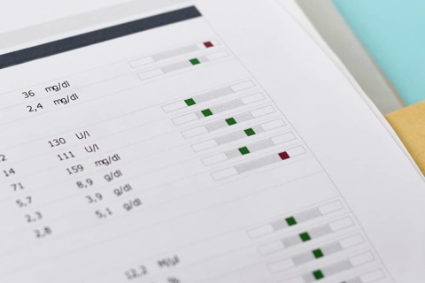 Close up of blood test results with green and red parameters on a medical report. Normal range,