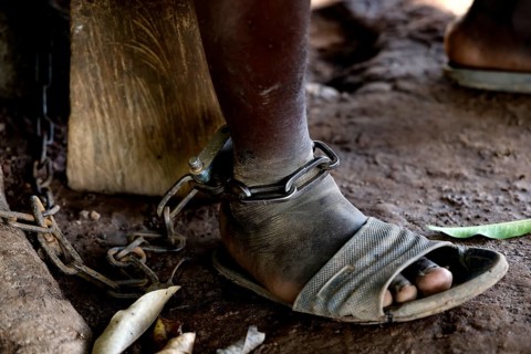 Close-up of foot in chains as a symbol of mental illness, Brobo, Ivory Coast