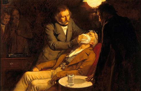 Zahnarzt, Betäubung, Anästhesie, Narkose. Die erste Verwendung von Äther in der Zahnchirurgie, 1846