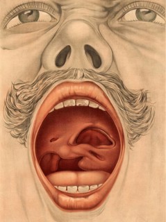 Medical illustration, clinical picture, venereal disease, palate perforation caused by syphilis,