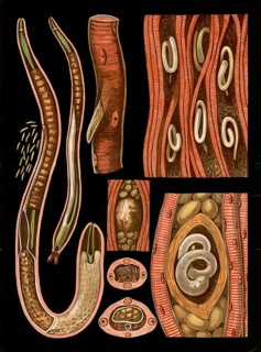Scientific illustration with details, nematode, trichinella spiralis, school picture, authentic