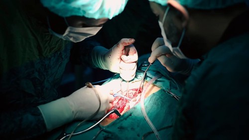 Several doctors performing a complex surgical operation inside an operating room for a displaced