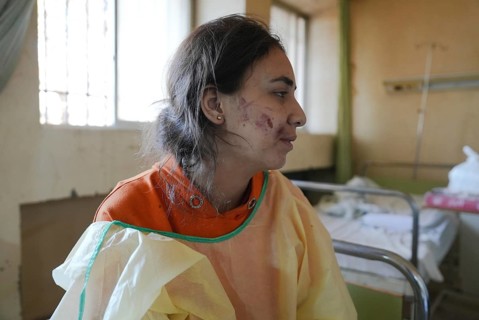 Wounded individuals receiving treatment at a hospital after being evacuated with difficulty from