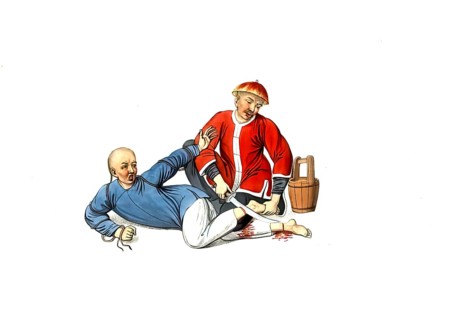 Jurisprudence, torture and punishment in medieval China, a criminal's legs are cut off. This