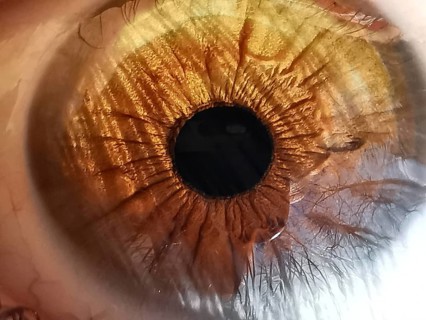 Close-up of an amber-colored eye in which trees are reflected shows the complex structure and color