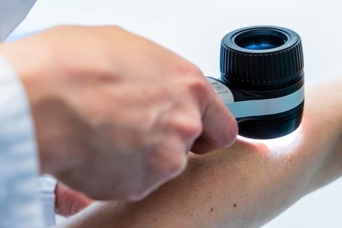 Dermatological examination with dermatoscope on a forearm, Düsseldorf, Germany