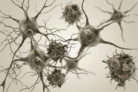 Macro-cross section of degenerating nerve cells with visible protein deposits to visualize