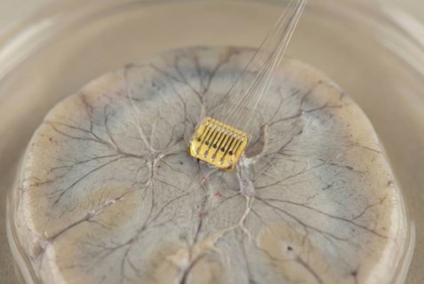 Realistic illustration of a neural implant in contact with nerve cells, AI generated