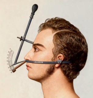 Median facial goniometer of Pierre Paul Broca, 1824 – 1880, French physician, anatomist and